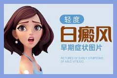 郑州西京医院不挂号直接去能行吗-在线医生咨询一下能吗